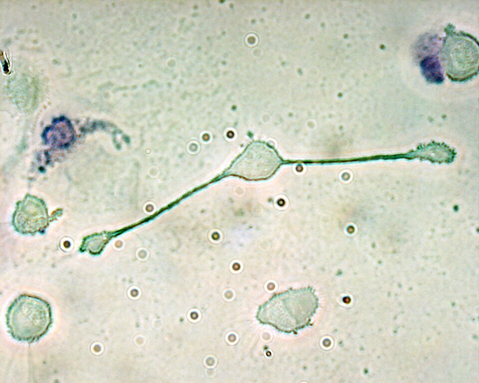 Light micrograph of a macrophage.